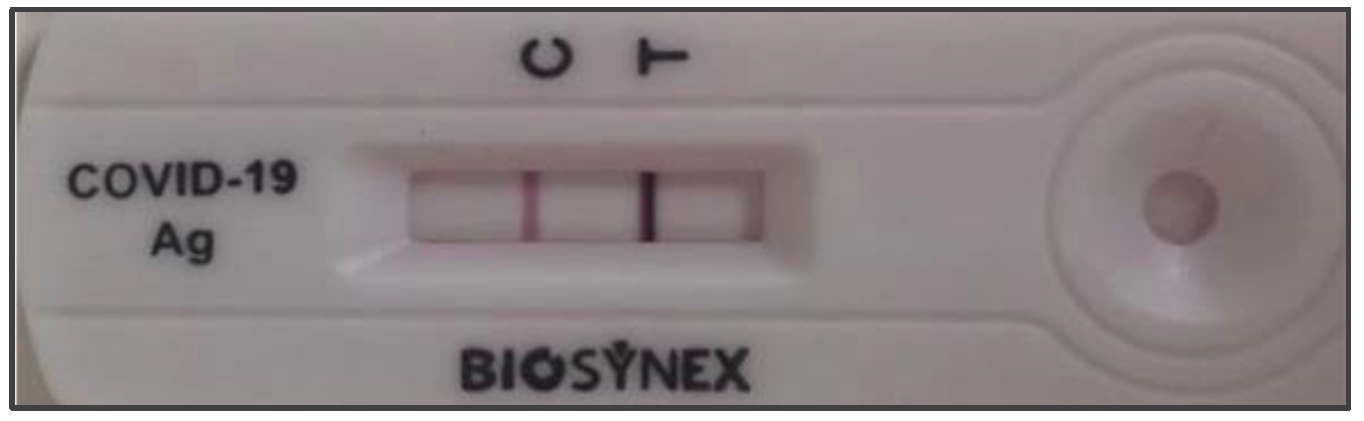 Évaluation de la performance diagnostique des tests rapides d'orientation  diagnostique antigéniques COVID-19