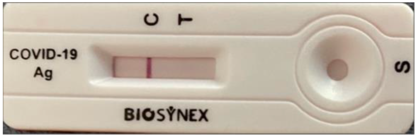 Les tests de diagnostic rapide du SARS-CoV2 : Quo vadis ...